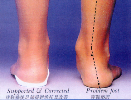 insole vs barefoot